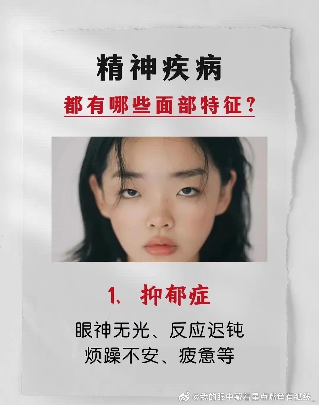 神经系统疾病 五大神经系统疾病，愿所有人远离！ 