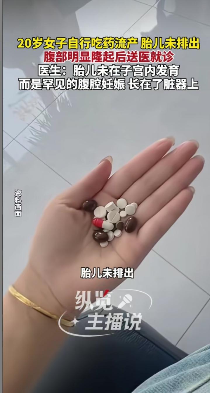 哈尔滨20岁女子药流未果 腹腔妊娠33周惊险获救
 
2026年1月，哈尔滨一名