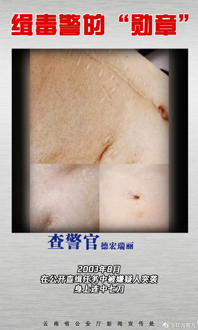 缉毒警的伤疤是摘不掉的勋章他们把黑暗挡在身前，把烟火安宁护在身后，伤疤无言，皆是