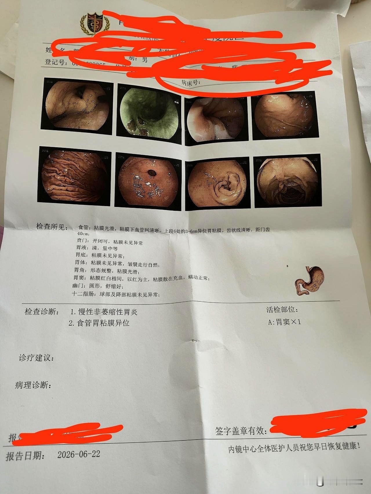 又为胃花了103块自费，换来一个月的安心。
今天复诊又开摩罗丹，一个月药255元