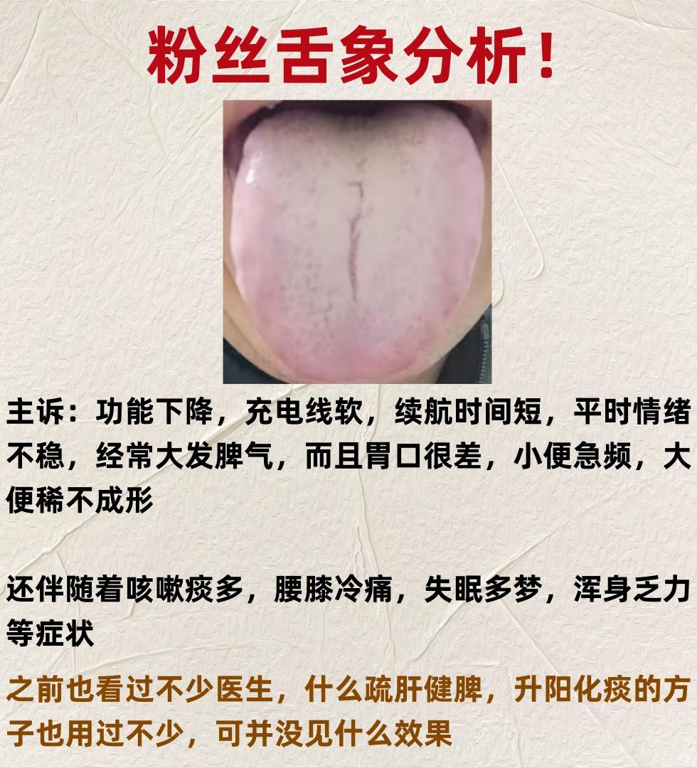 今日粉丝舌象分析，拍的越清晰分析越准确！

每天坚持为大家分析舌象，为你的健康保