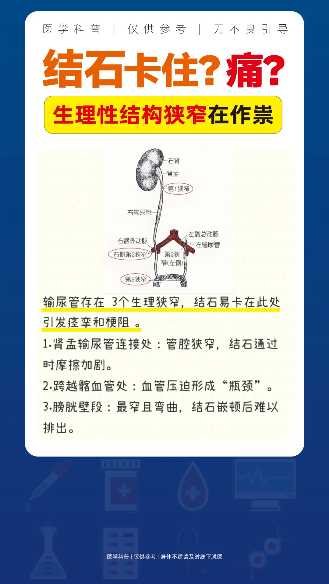 结石卡住为什么这么疼疼???原来是这些原因在作祟