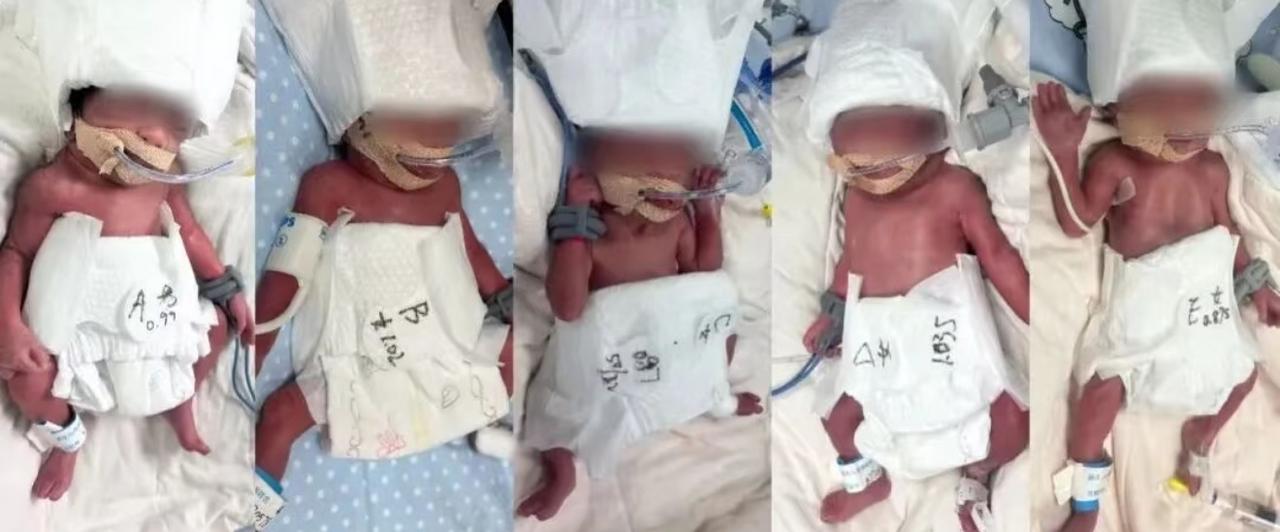 这个女士真是会相应国家号召，生了个五胞胎
2月25日23时30分左右，一位来自新