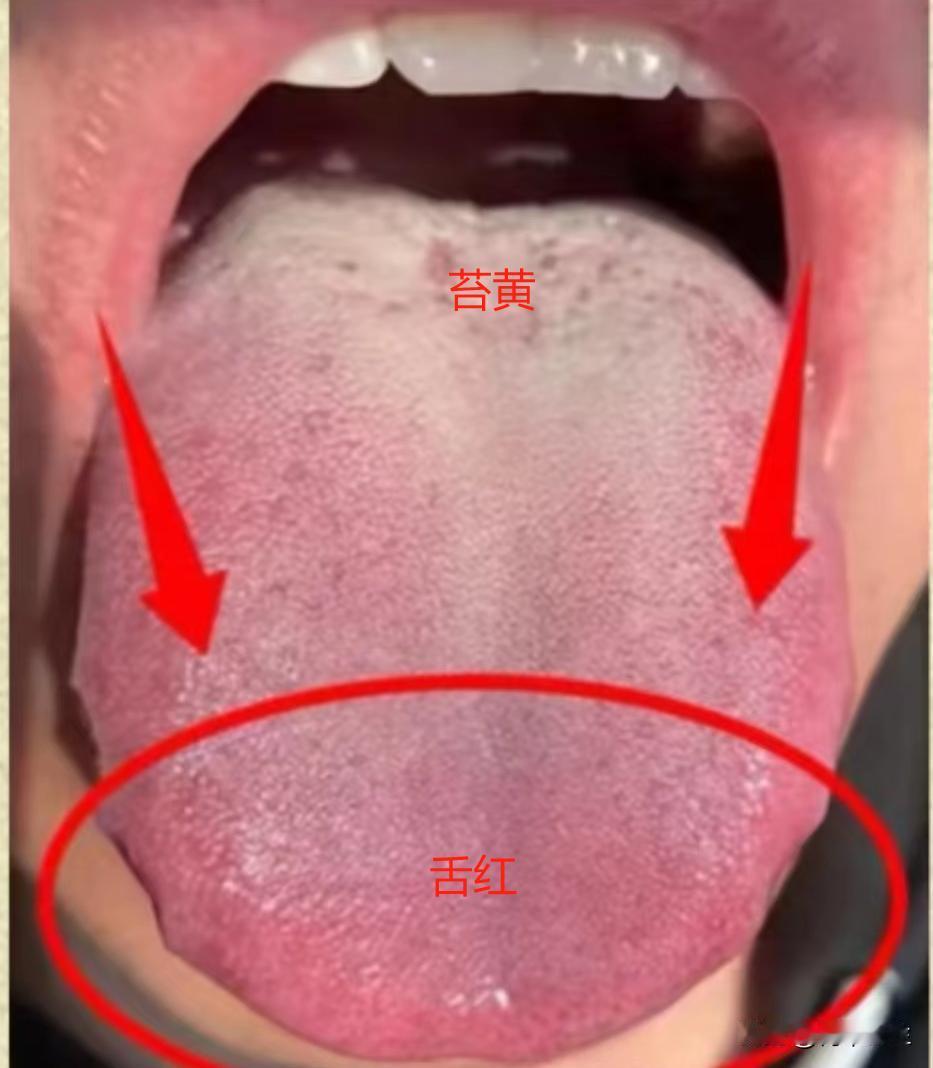 小便发黄可不是简单的上火，很可能是心经有热，这样调理简单有效

这是一位后台粉丝