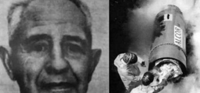 全球首例被冻了几十年的人解冻时，打开液氮罐的瞬间，在场的人都吓了一跳 —— 那场