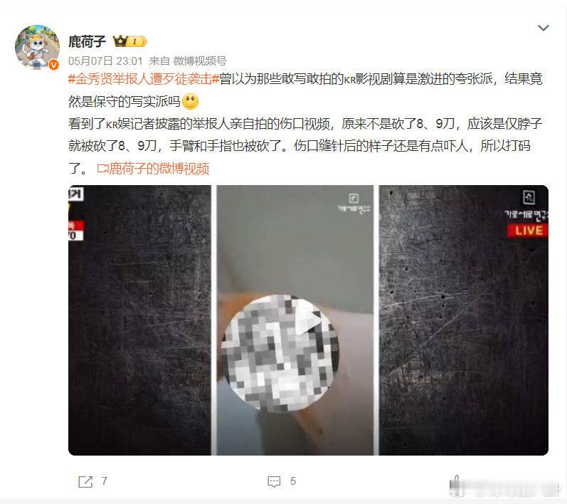 金秀贤举报人遭歹徒袭击韩娱太黑暗了 连暗鲨都不搞了 直接明鲨 难怪那么多艺人紫砂