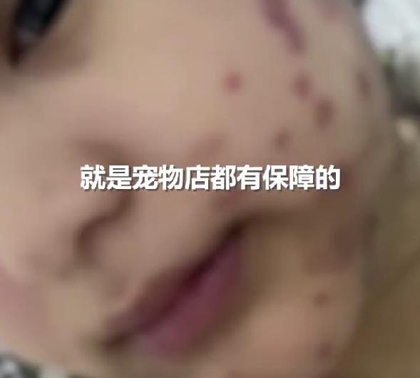女生800元买猫被传染全身长猫藓 商家不愿退赔，未成年太无助
真的太让人气愤了！