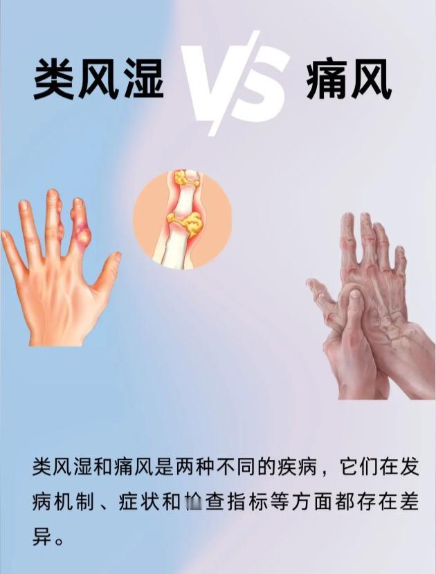 关节痛分不清是类风湿还是痛风？一文教你看懂区别