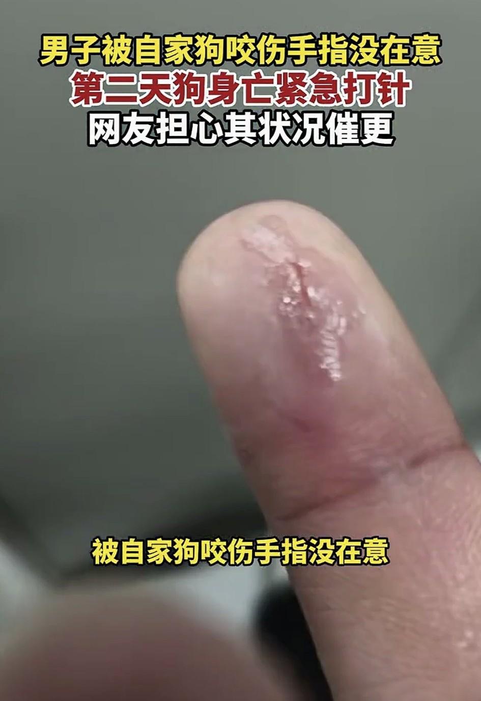 河南，一男子被自家狗子咬伤手指后没在意，结果第二天狗子突然身亡，吓得男子赶紧到医