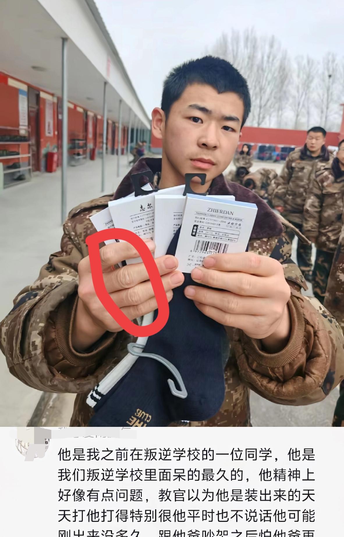 河南濮阳，这张照片据称拍摄于戒网瘾学校期间的17岁张志明。画面中他手指关节较为粗