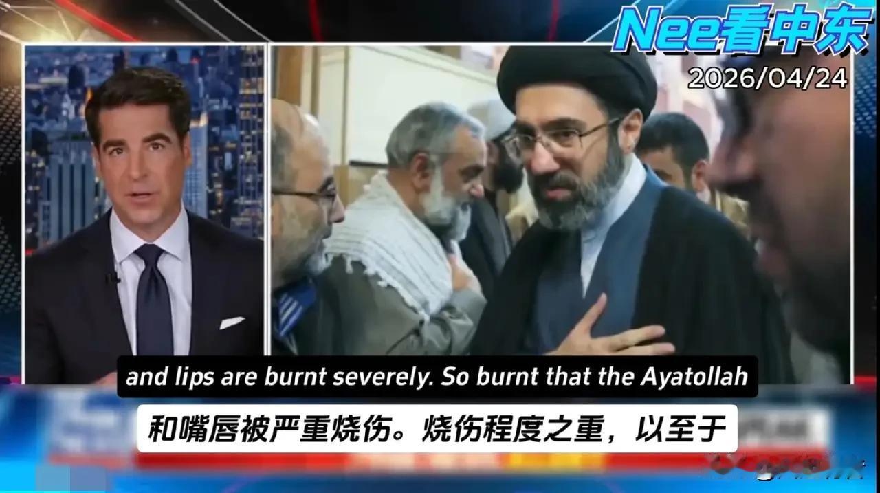 美国媒体大肆炒作伊朗最高领袖继承人穆杰塔巴·哈梅内伊伤情及伊朗国内局势混乱，背后