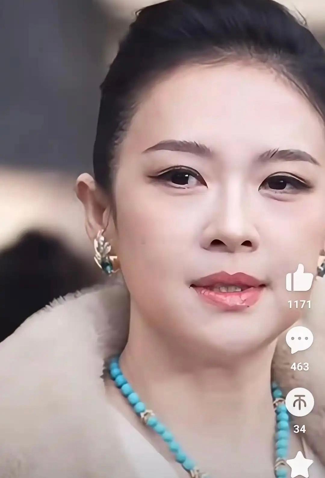 才发现章子怡眼睛上那个小黑点不见了 