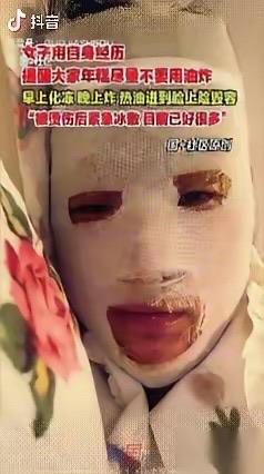 就为了一口吃的，一张脸，可能就这么交代了。
安徽一个姑娘，嘴馋，想吃炸年糕。冰