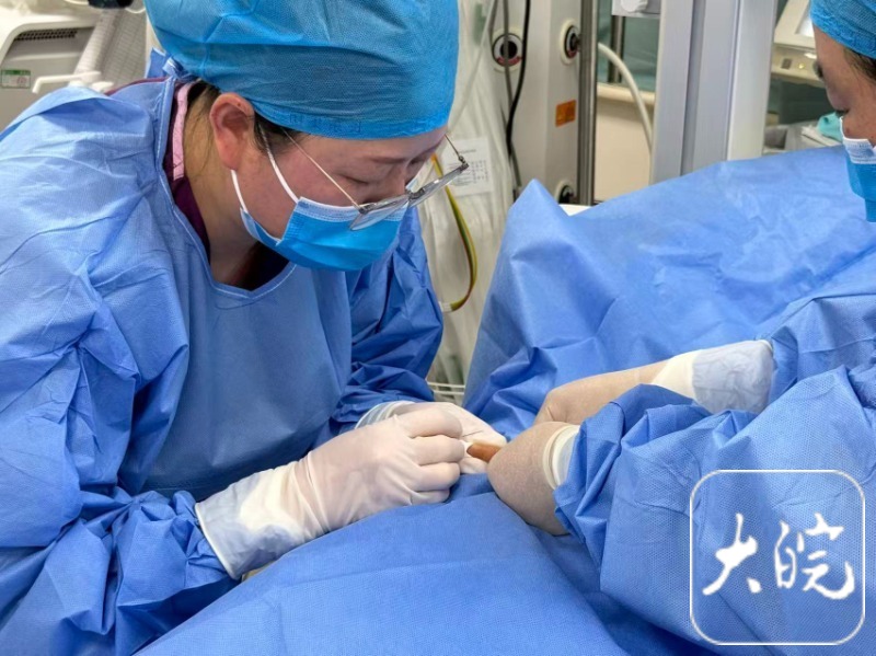 亳州550克重超早产儿被成功置入“发丝级”PICC导管