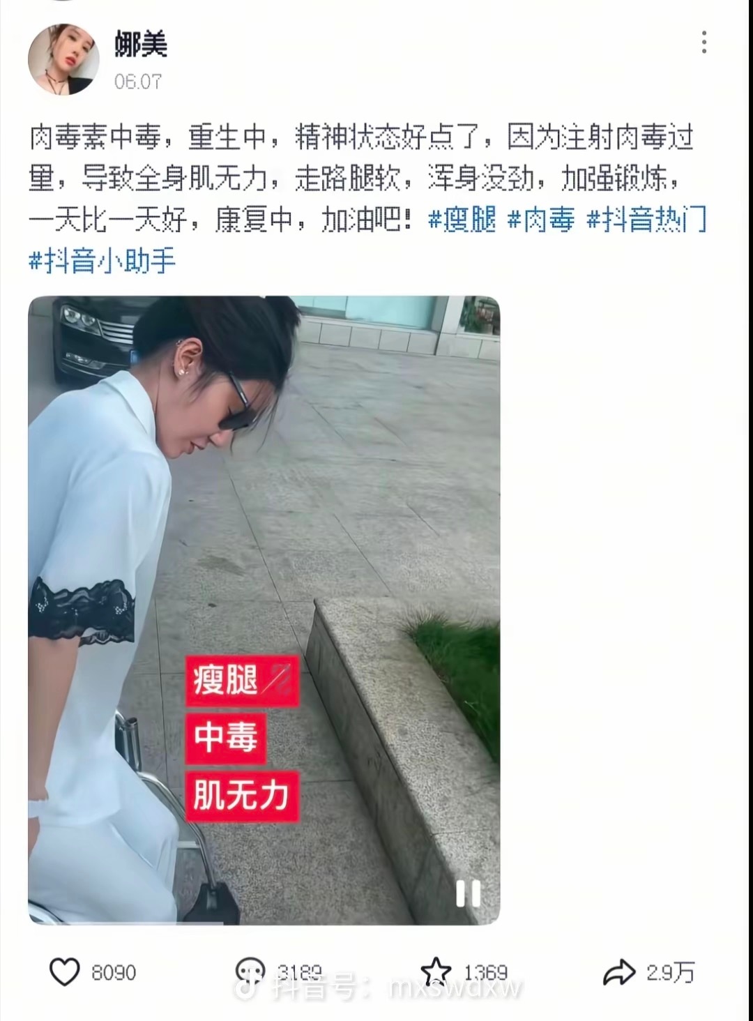 娱乐圈也是蛮有趣的，有女艺人打肉毒素打多了中毒，有男艺人打玻尿酸打出问题的[泪奔