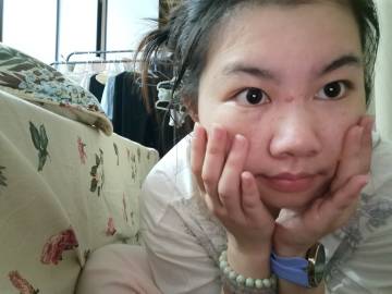 大痘在成熟，我也在熟