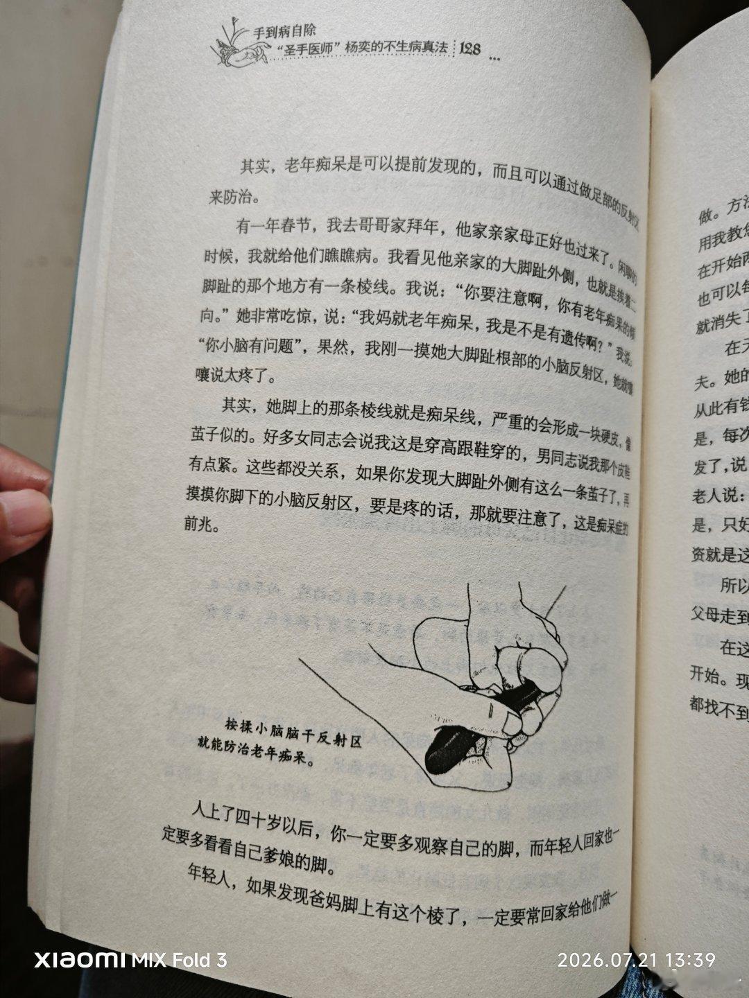 我的脚就是这样，痴呆线很明显，而且都不敢按小脑反射区，手轻轻碰着就疼。 