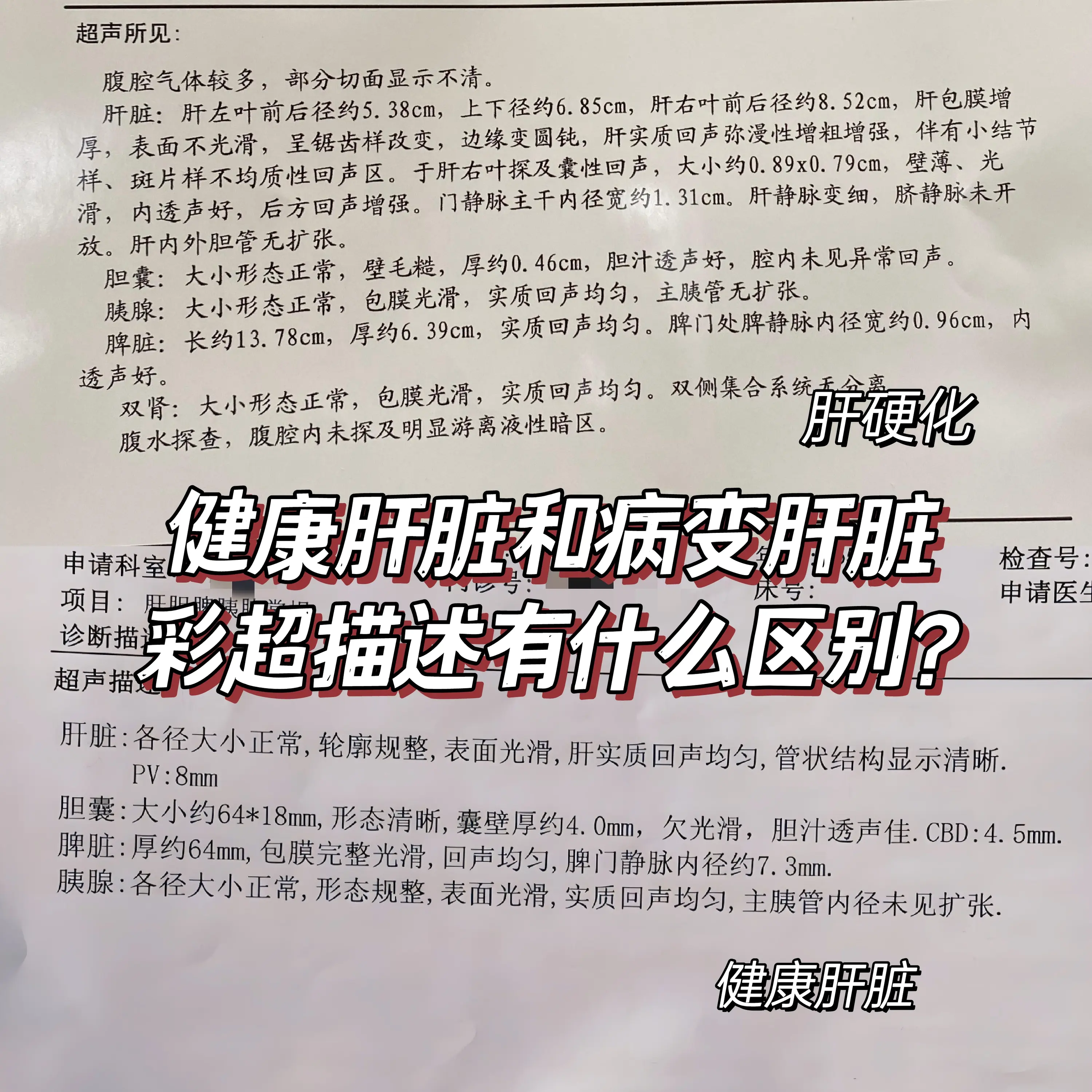 健康肝脏和病变肝脏，彩超描述有区别！。彩超相信大家都不陌生，对于肝病患...