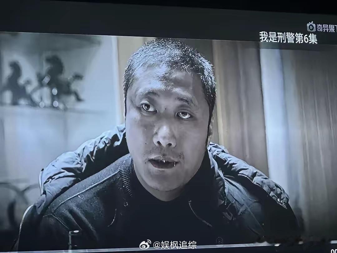《我是刑警》这种眼神是斜视眼还是格愣眼？有网友说这是格愣眼 ，电视剧给我扫盲了，