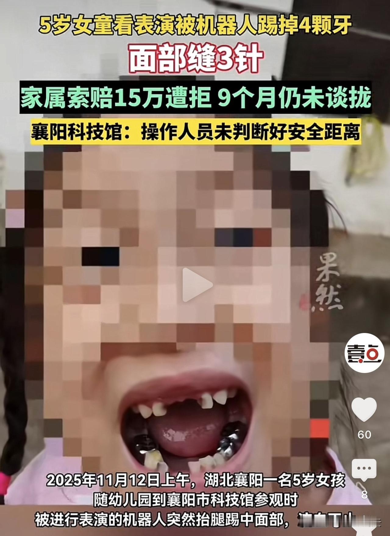 湖北襄阳，5岁小女孩观看机器人表演，却直接被踢倒了！小女孩牙齿掉了4颗，嘴唇缝合