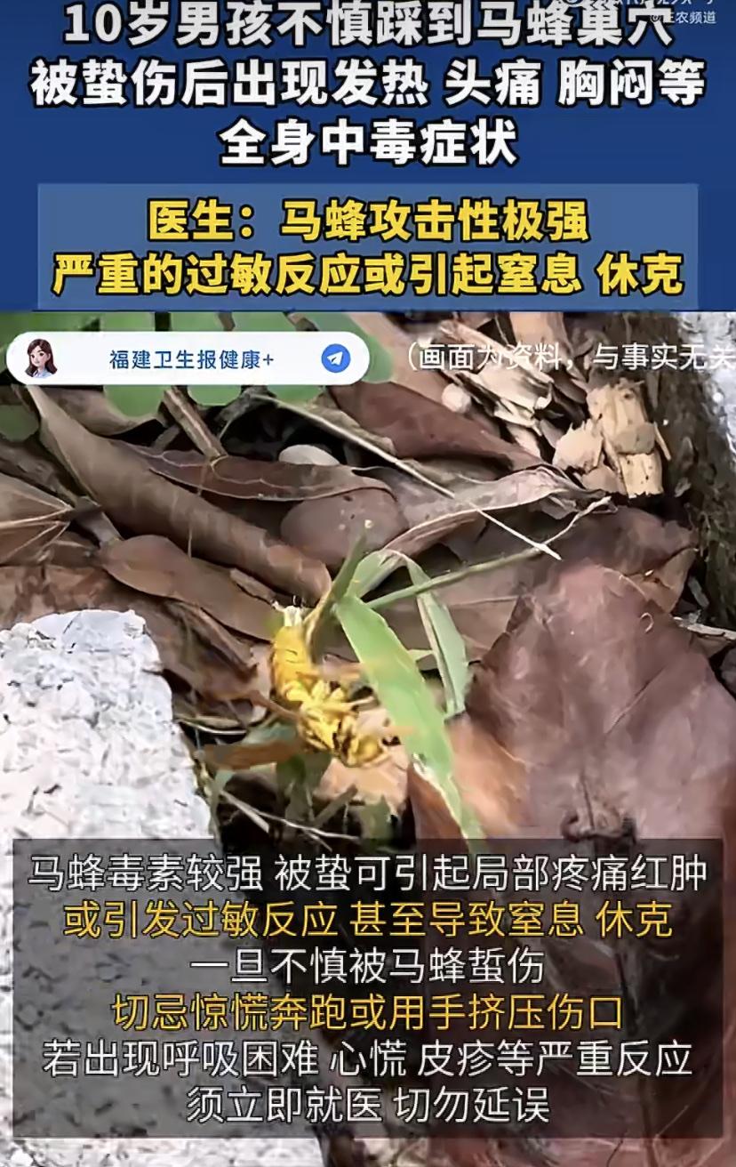 湖南10岁男童操场踢球遭马蜂围攻，浑身肿痛还发烧胸闷，医生:这个季节马蜂最暴躁!