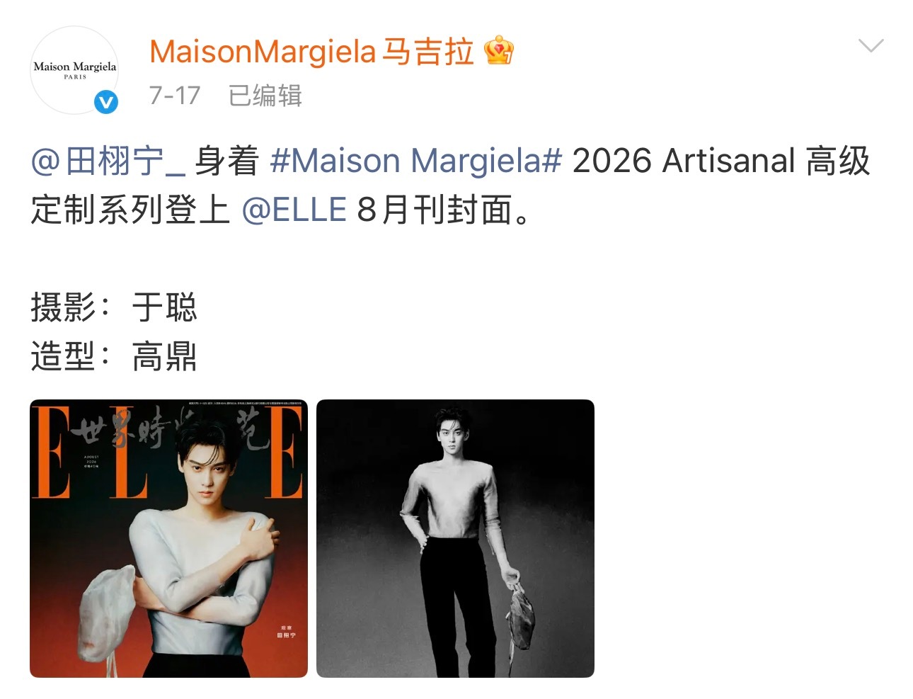 田栩宁马吉拉全球首穿 是ELLE邀封是马吉拉全球首穿且光速认领是内娱五大杂志销售