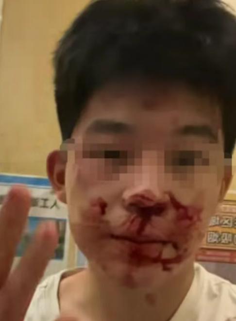 冒充民警打人者拘12天，借高考名义提前释放，22万买受害者闭嘴！民警子女就能肆意