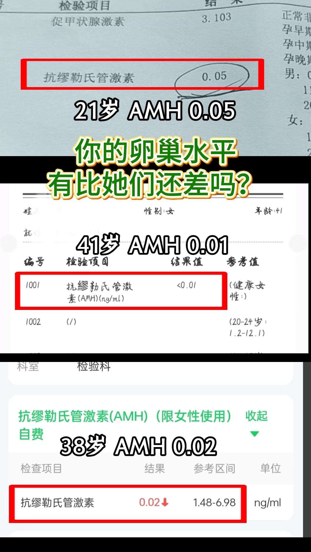 你的卵巢水平有他们的差吗？。所有的美好都会奔你而来！
