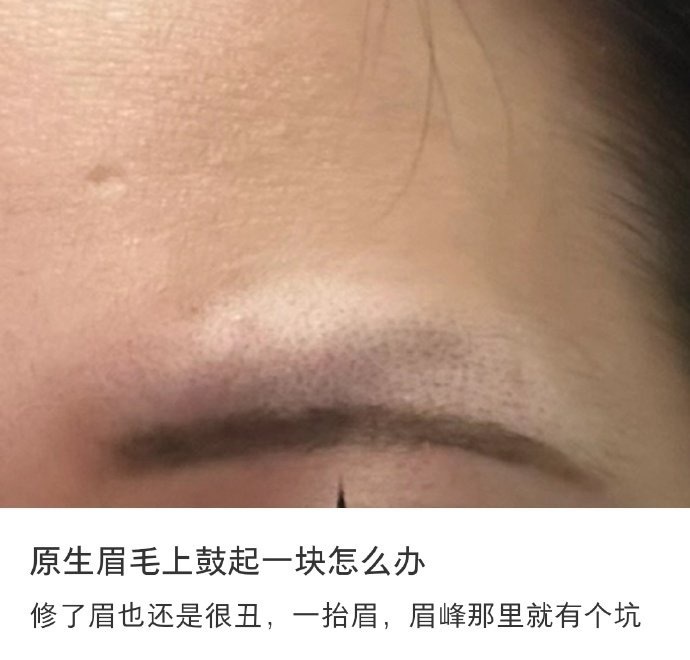 眉骨：我多余呗 ​ ​​​