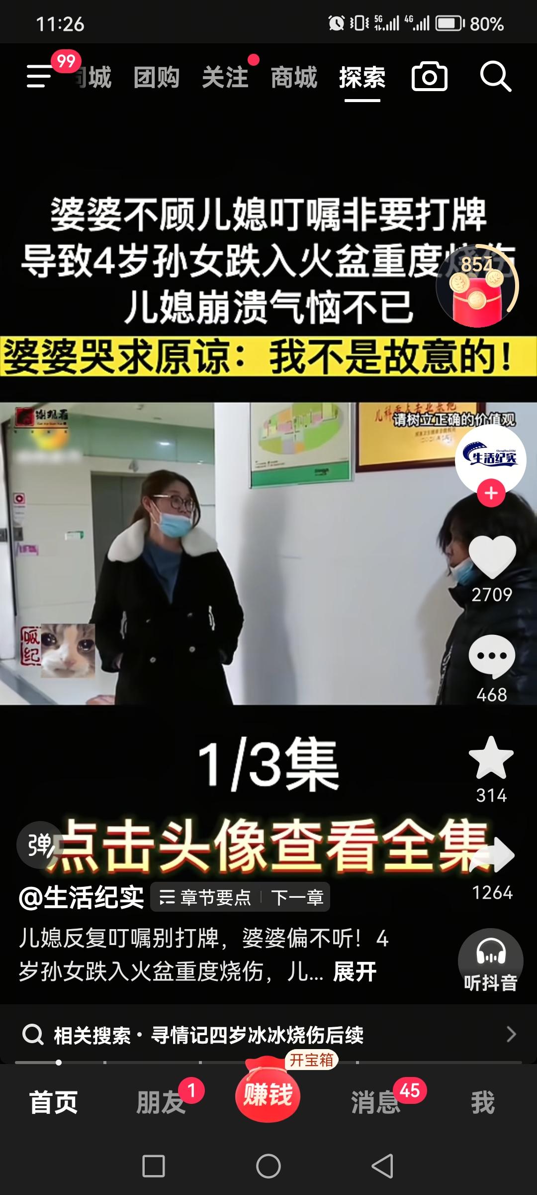 婆婆不顾儿媳叮嘱非要打牌，导致4岁孙女跌入火盆重度烧伤，儿媳气恼崩溃不已。婆婆哭