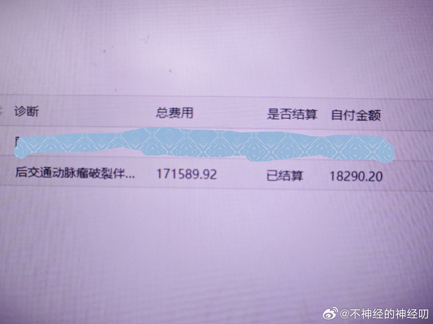 刚刚点了一下昨天出院的两个病人的费用清单。这个病人动脉瘤比较大，弹簧圈填的比较多