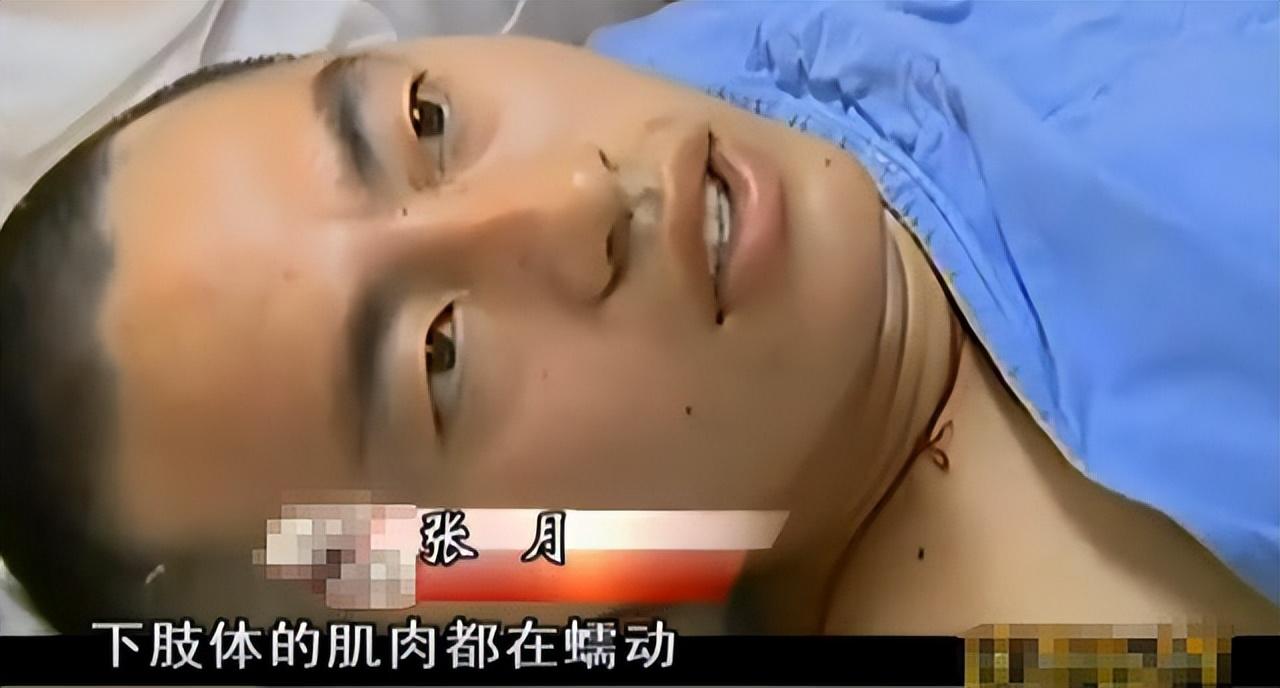 “比凌迟还要难受！”2020年，山东一21岁小伙因严重烧伤面临截肢，危急关头，医