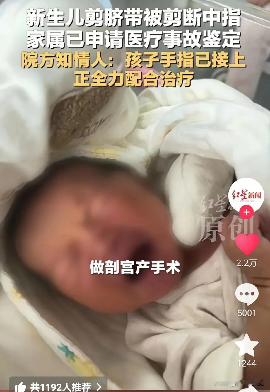 看着让人心疼！近日，江苏一名宝宝刚出生便因助产士疏忽，被剪断了手指。
12月25