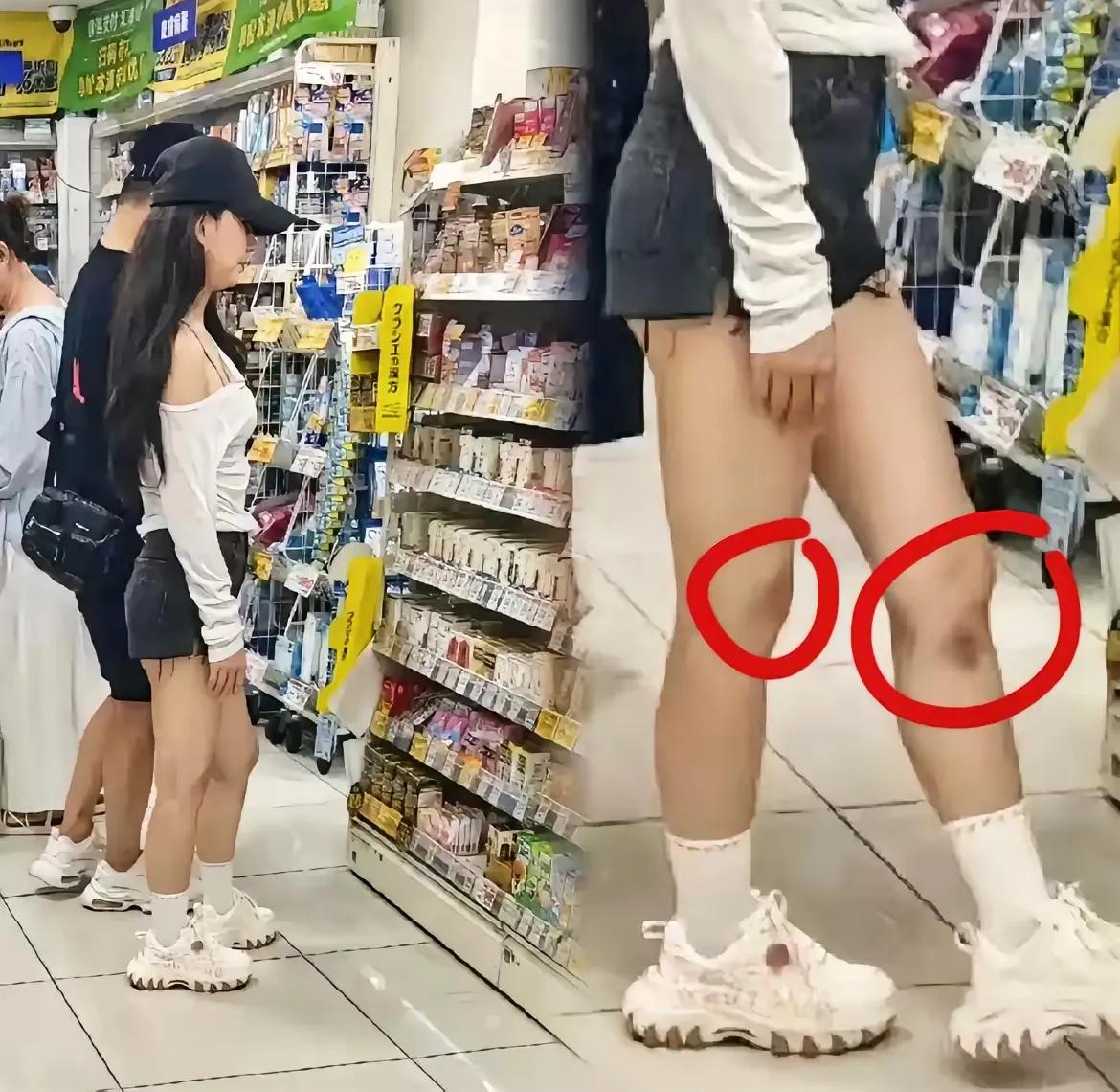 森林北的两个膝盖严重淤青，汪峰真是单身久了火气大呀！不过，他也不是那种纯粹的不知
