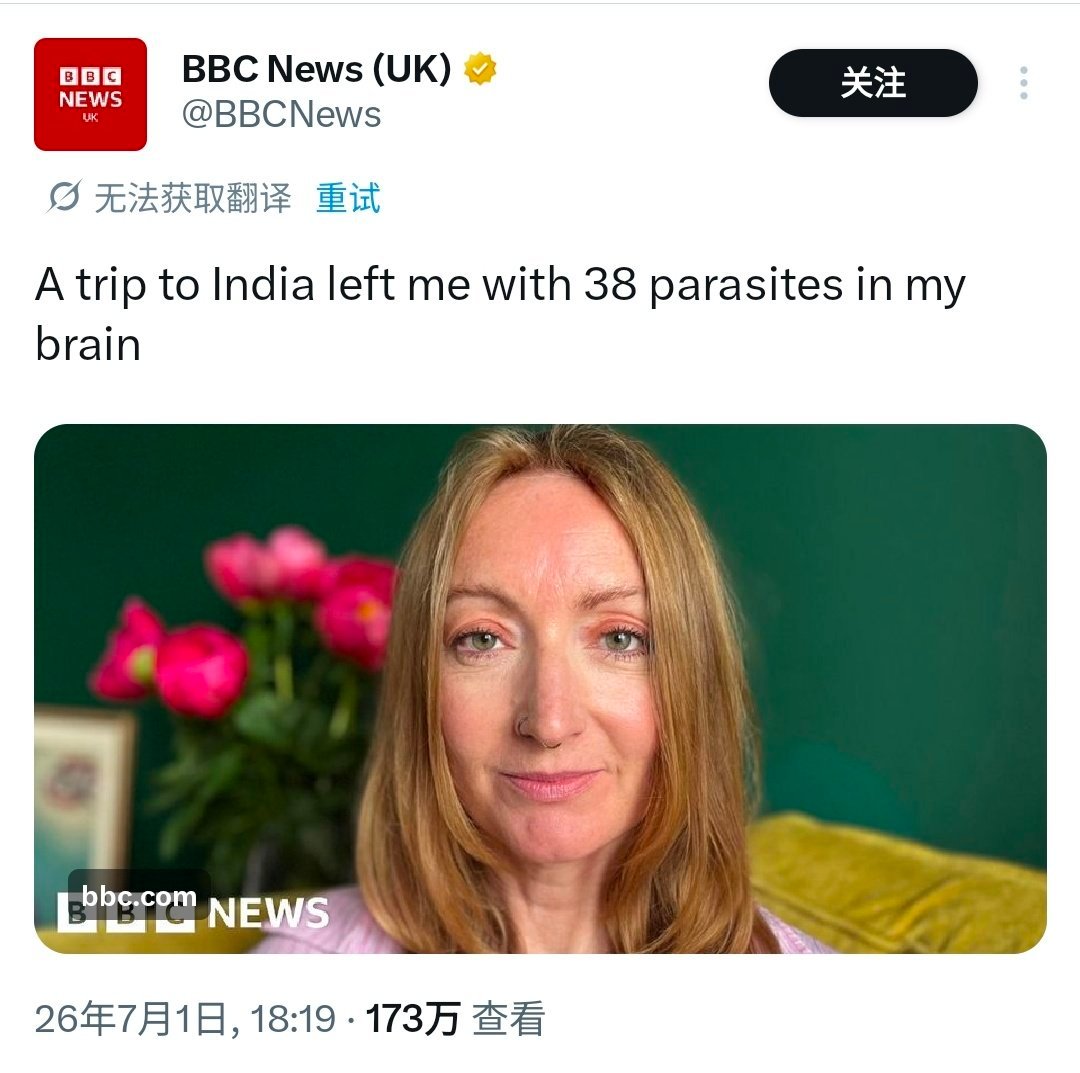 英国媒体报道，这位英国女士一次印度之行，在她脑袋里感染了38条寄生虫。从事媒体工