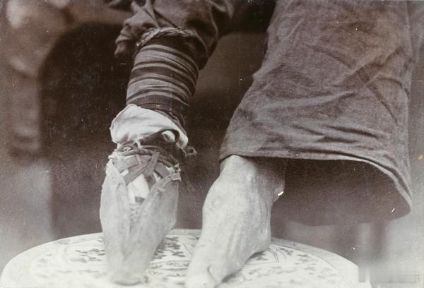 小脚女子，1902年 ​​​