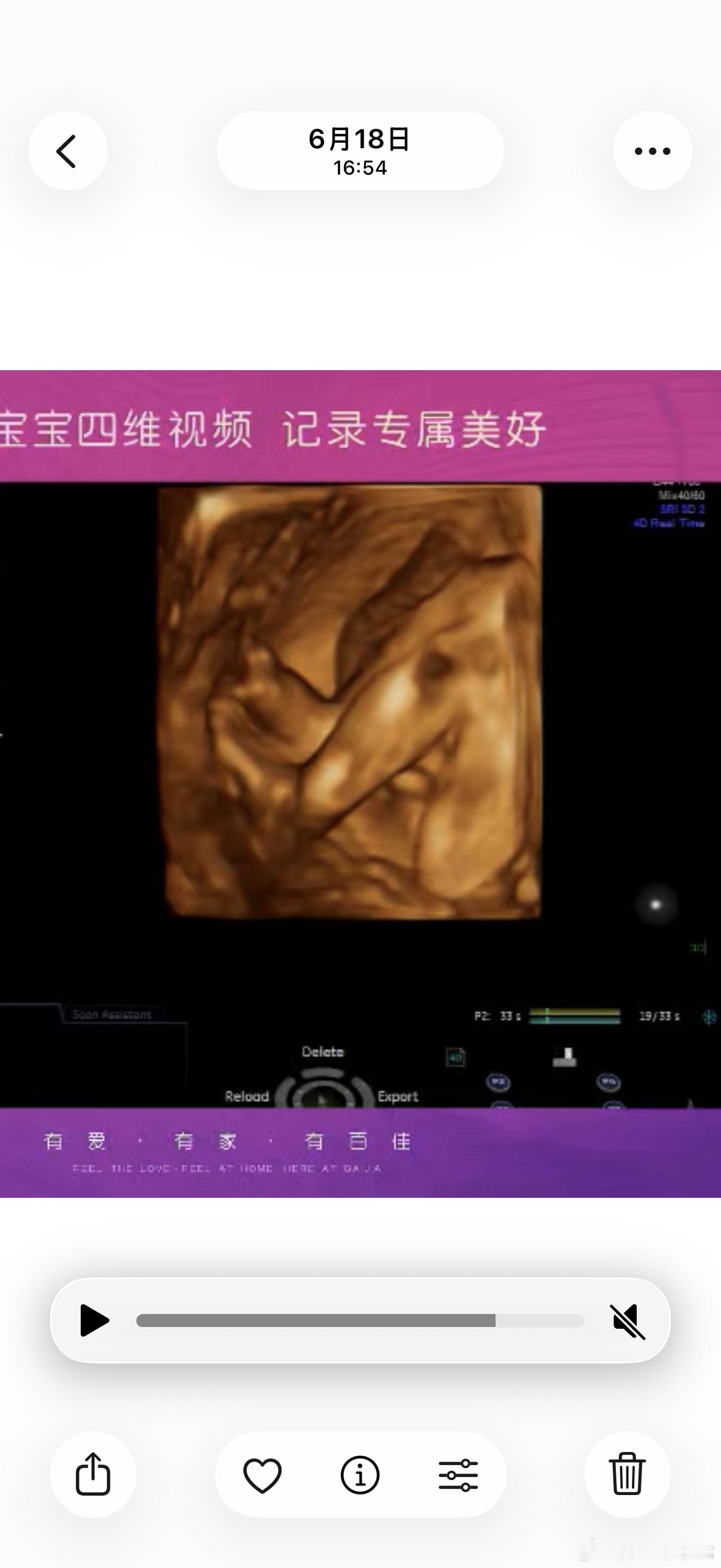 哈哈哈哈哈哈这腿有力道 给我昨天半夜里踹得猛猛哭