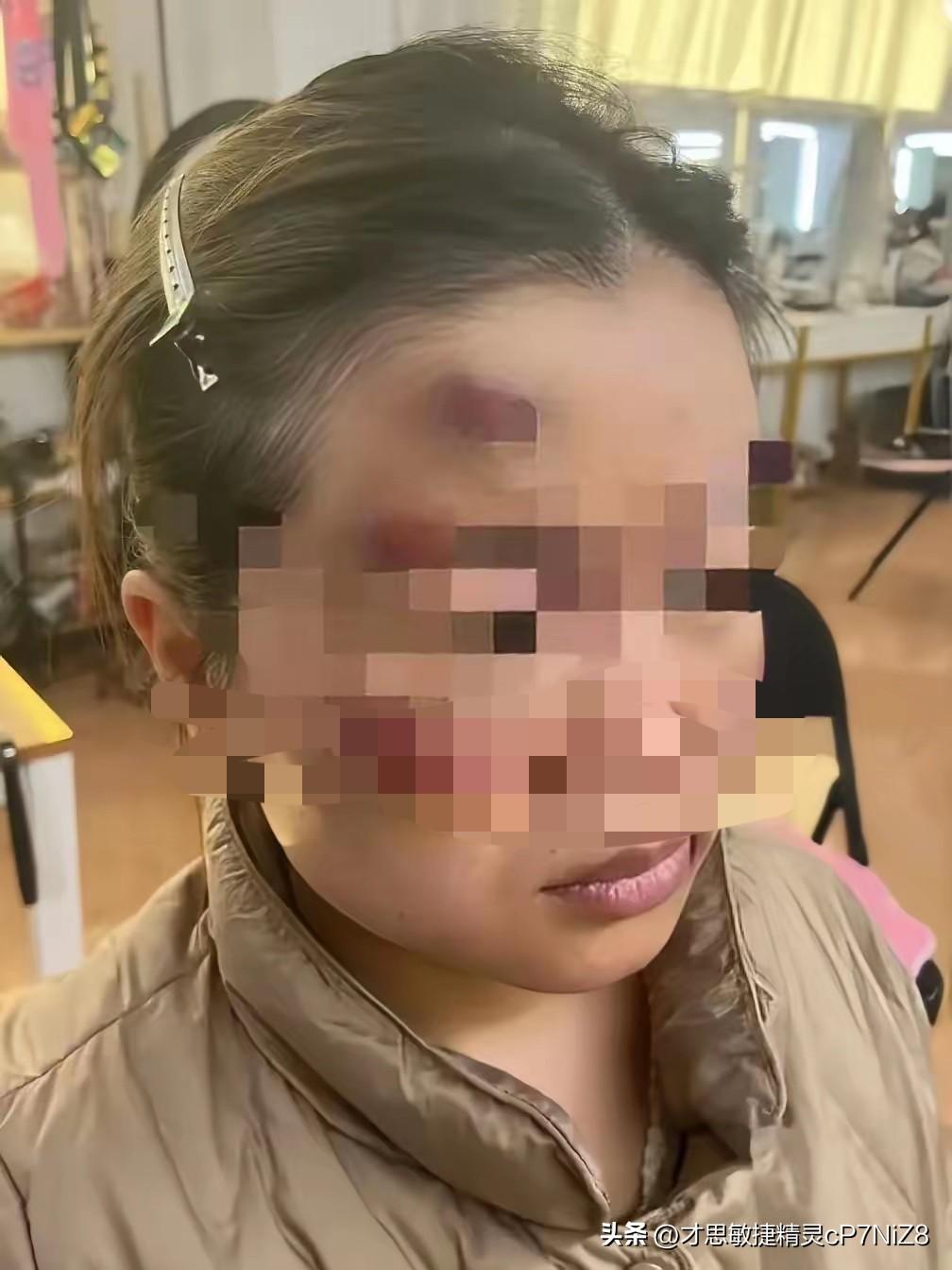 丈夫拿皮带抽了妻子十年，这次是因为菜咸了，三天后他倒下了，婆家全跪到她面前！那天