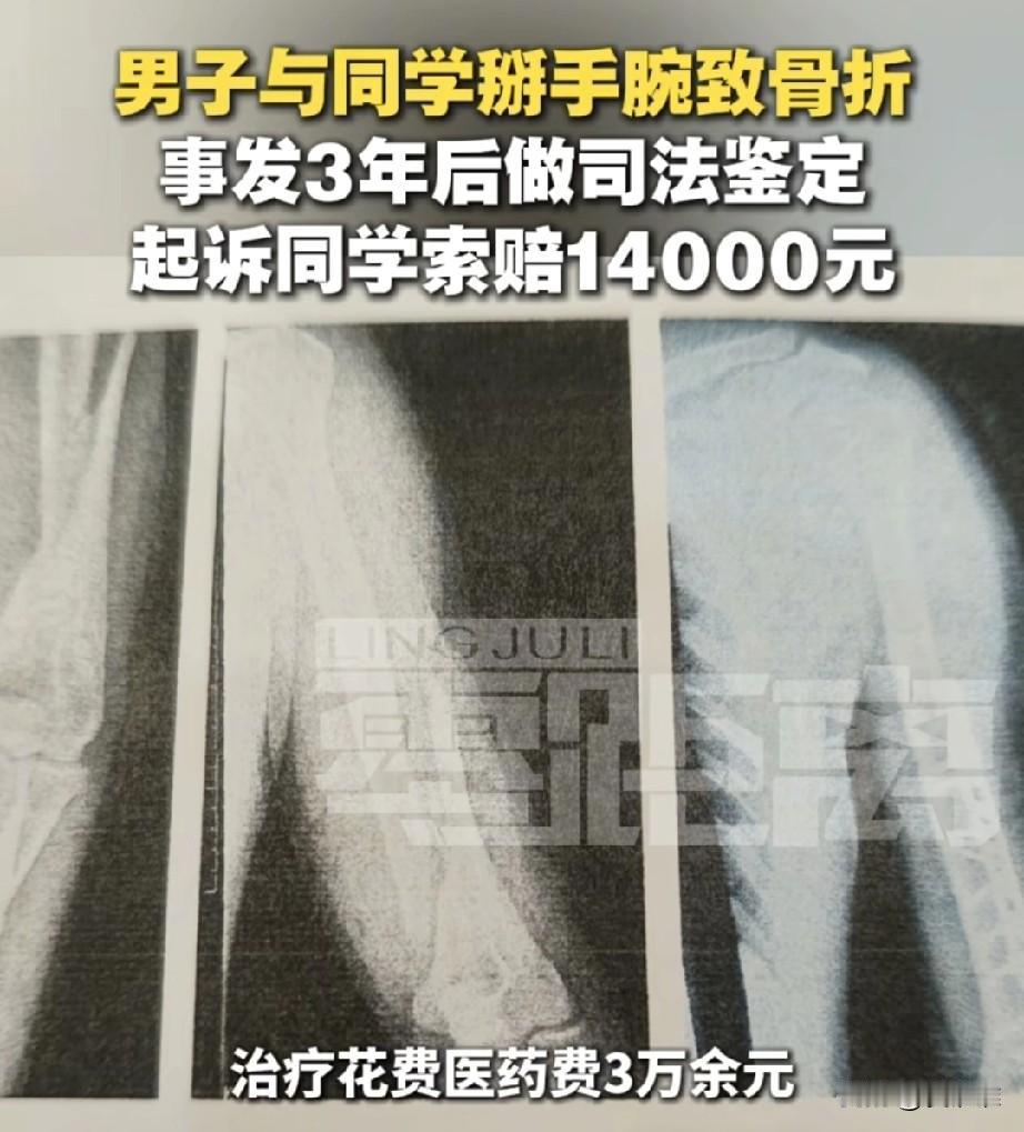 “不应该啊！”两个初三男生课间时间掰手腕，致使学生冯某手腕骨折，手术结束后冯某家