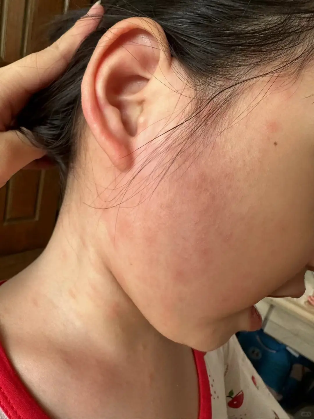 女儿猫毛过敏上岸！跟猫咪放心贴贴