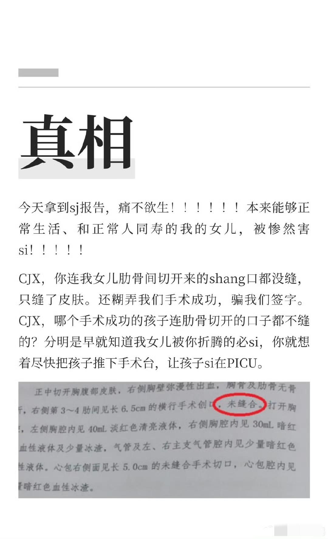 s检报告出来了，
每一条都挑战人的下限！

1、没有所谓的7mm房缺，没有症状，