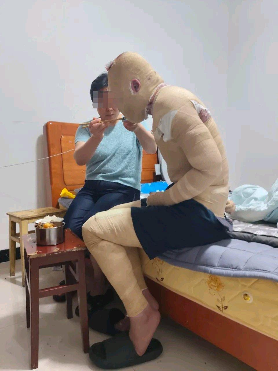 武汉大三学生在外租房因室友电瓶燃爆全身烧伤 一审判决：伤者担责15%这一判决结果