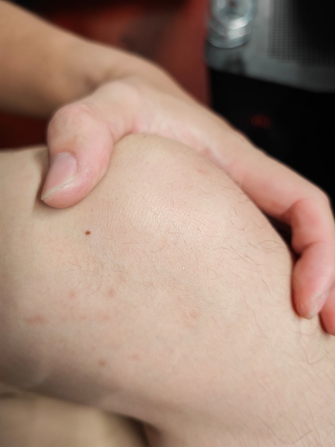 悲剧了，连续爬了两天山，我现在左边膝盖疼，而且不是那种刺痛，是感觉膝盖骨下面疼得