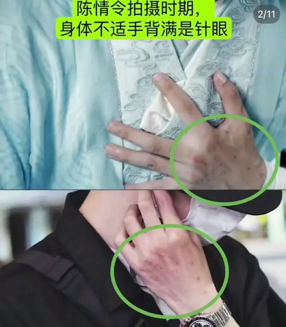 合作方曝王一博有严重的高反我只知道，拍戏的时候发高烧一声不吭，直到凌晨两点，化妆