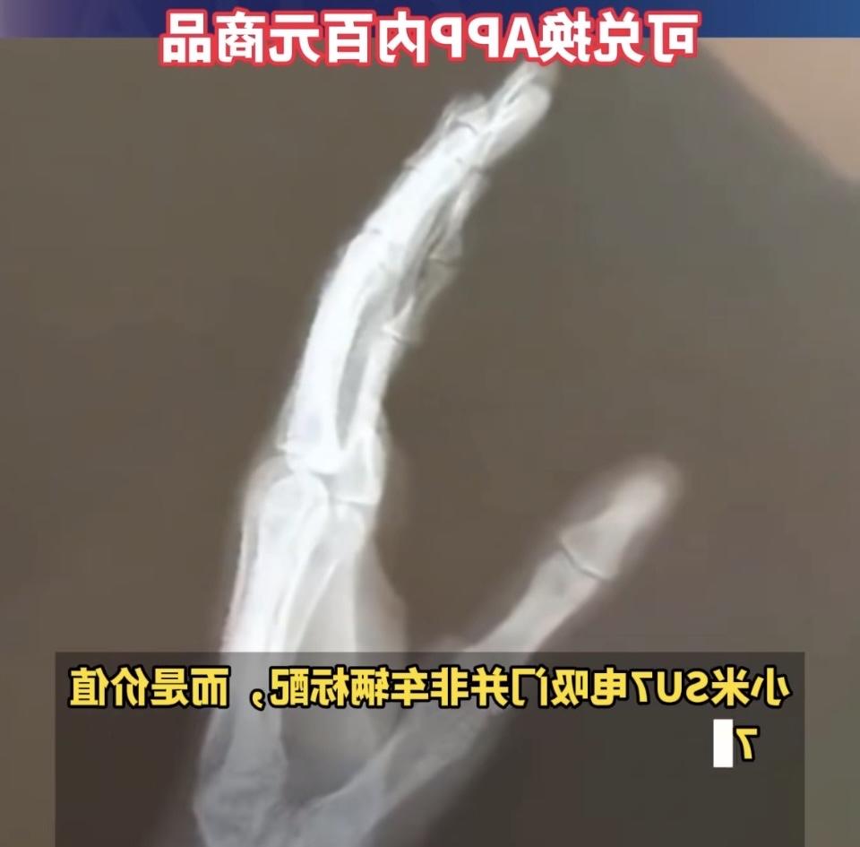 自费加装电吸门夹伤手指事件反思

有车主自行花钱给车辆选装了非原厂标配的电吸门配