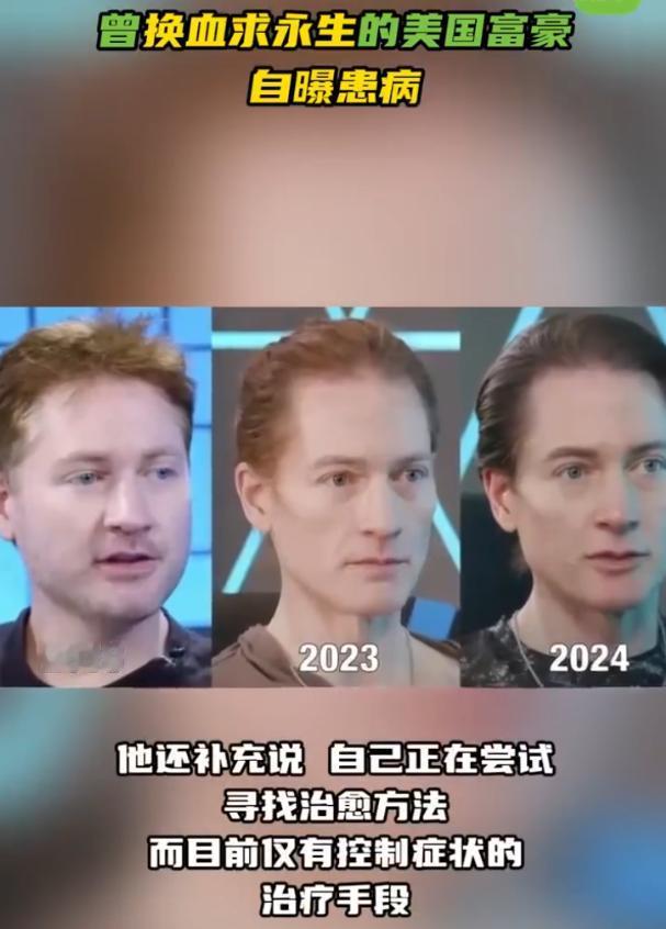 美国有个富豪，叫布莱恩·约翰逊，今年48岁。这人这些年干的事，说出来你可能觉得像