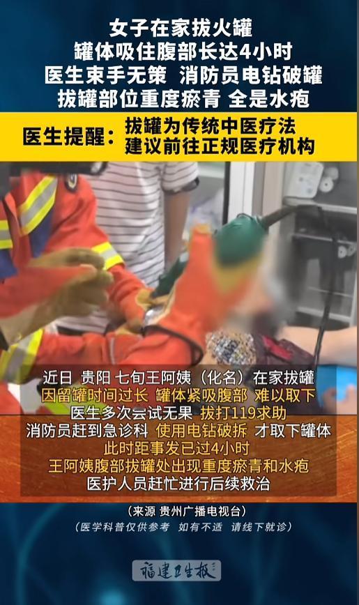 “悲剧了！”近日，贵州贵阳，一位七旬女子在家里拔罐，结果罐体在身上待得时间太长，
