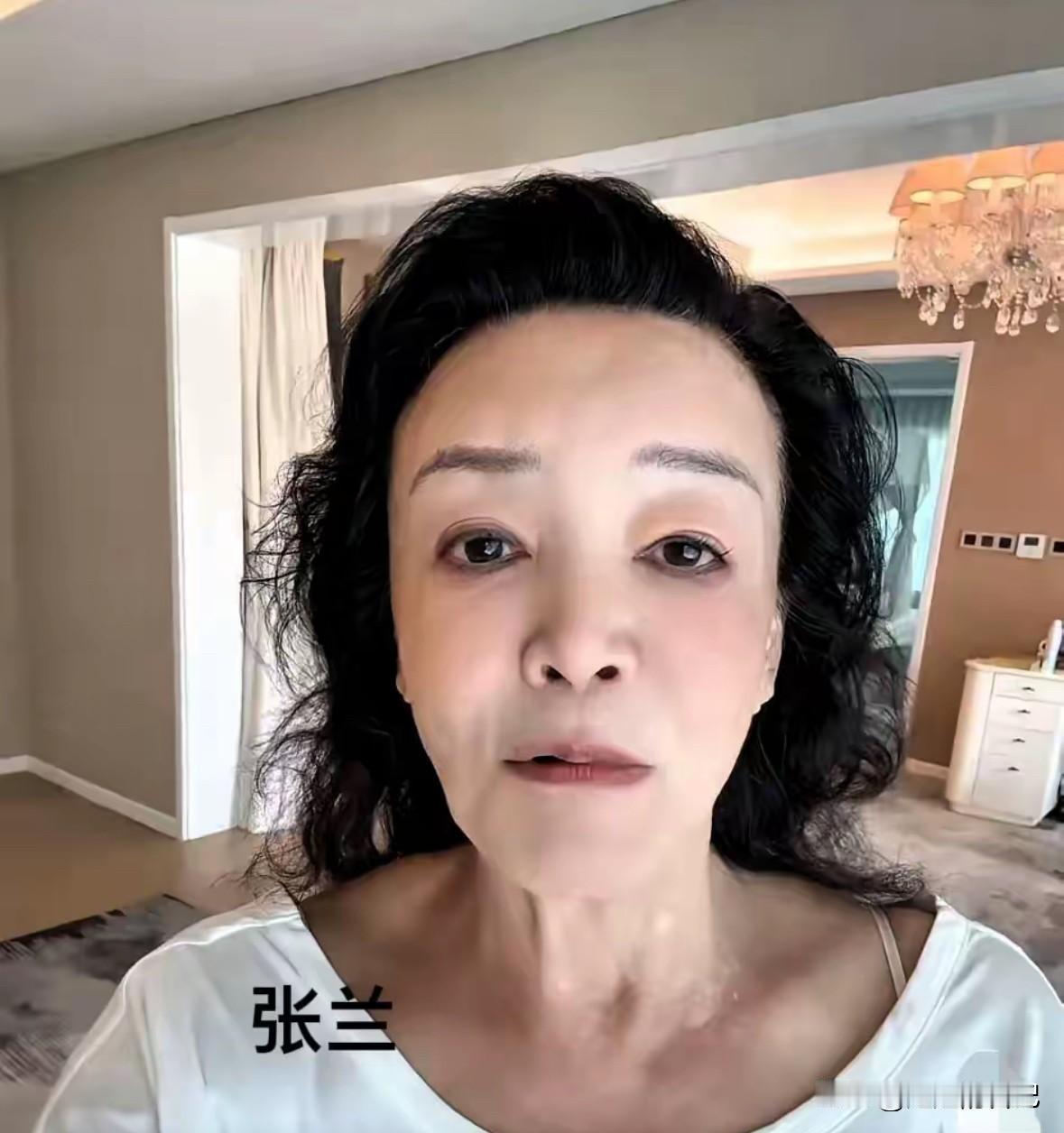 张兰怎么了？眼窝深陷，脸颊也塌了下去，之前丰满的面部，现在也剩下一条条，脖子上的