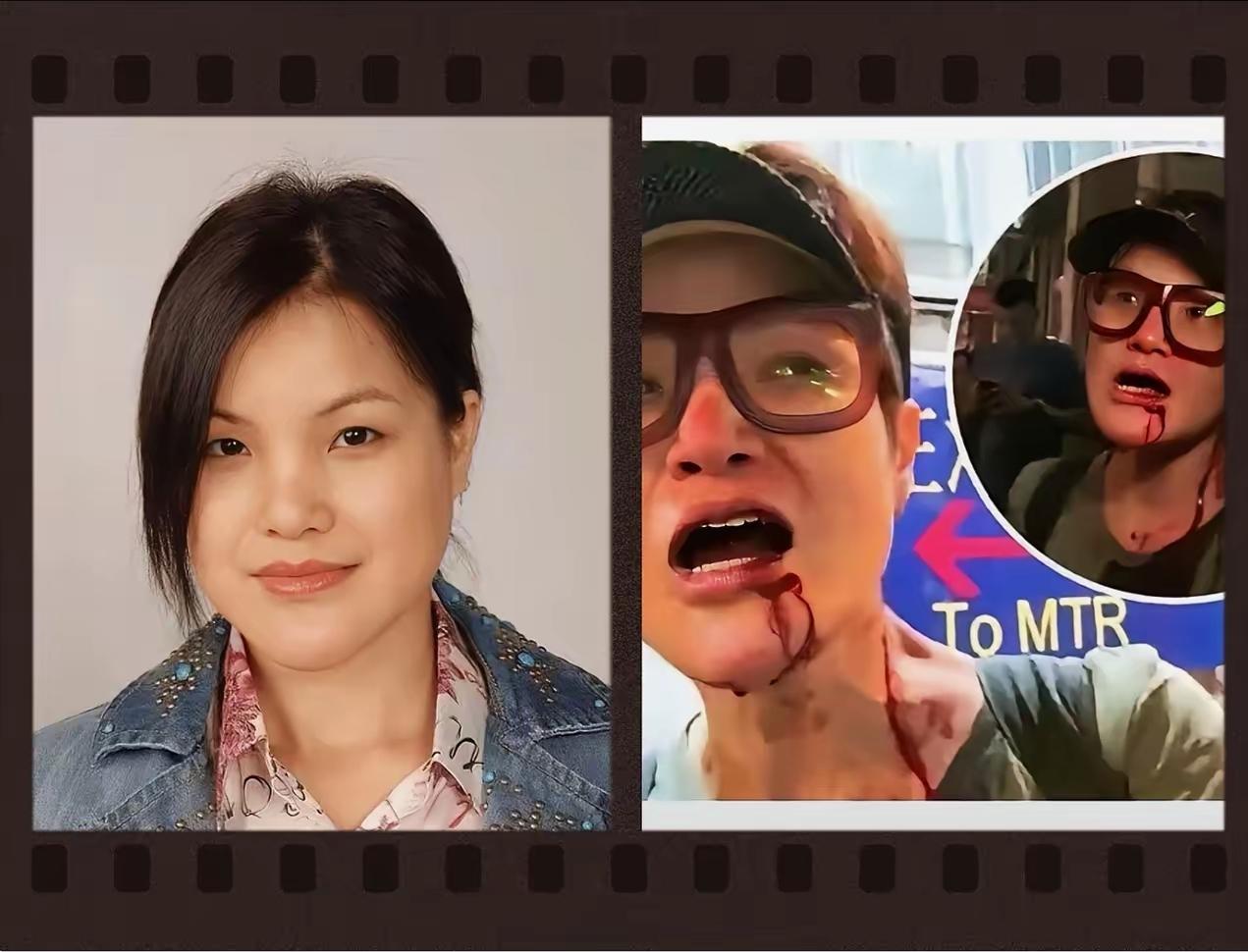 还记得当年香港“黑暴”时，马蹄露被打得头破血流的画面吗？
 
​那时候敢站出来跟