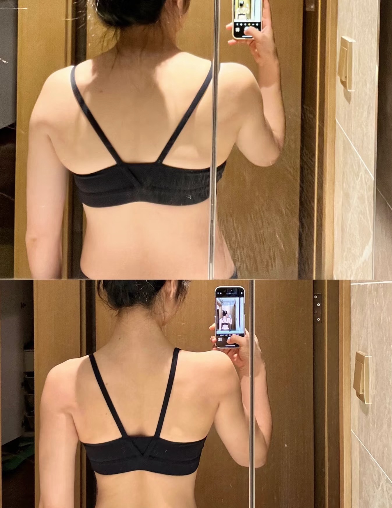 斜方肌就是一个巨大的讨好型人格抬头纹的生长是不是也有你的功劳？久坐、圆肩、看手机